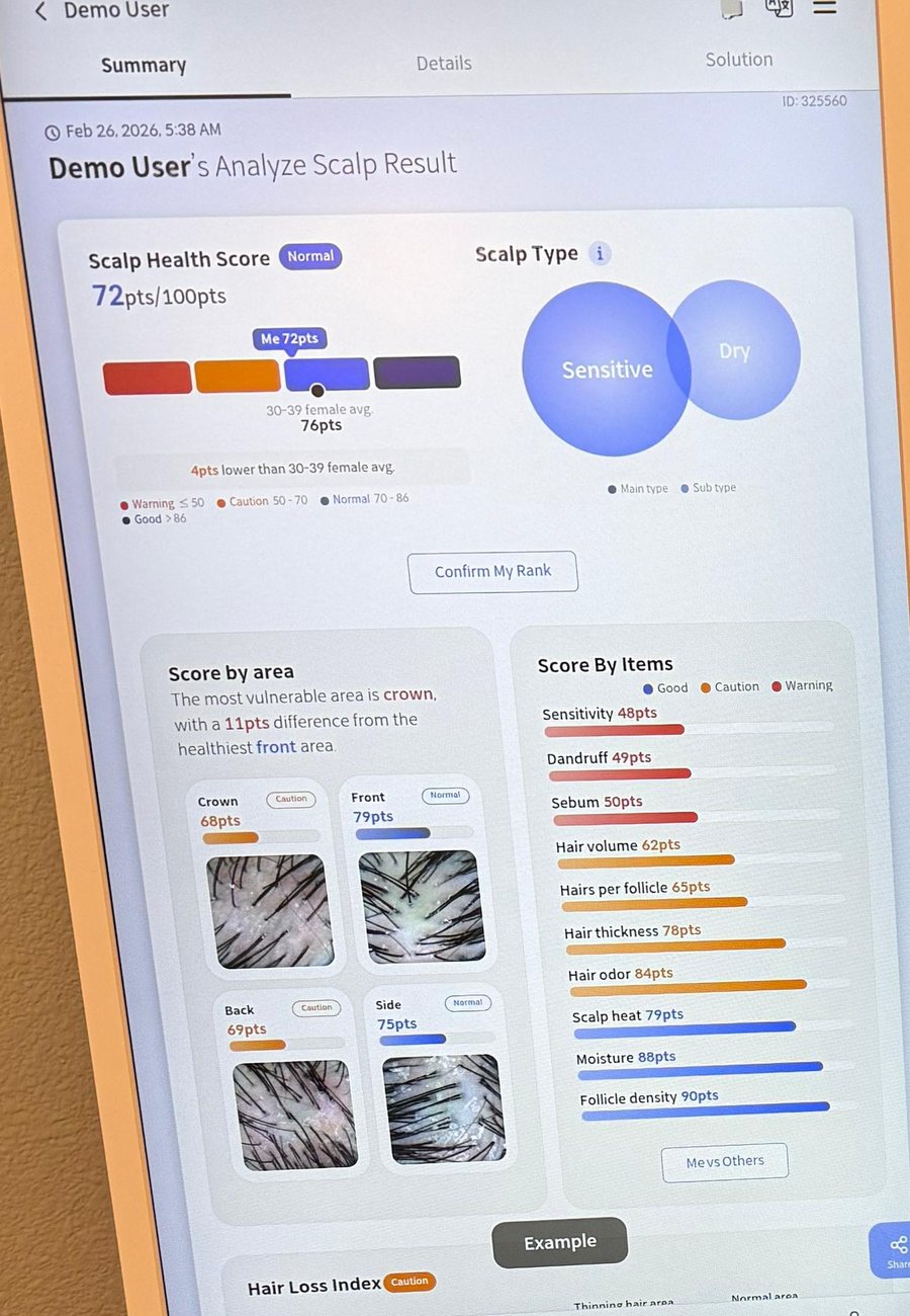 Scalp analysis results on screen at Core & Crown Collective in Fort Collins, scored by area and by item
