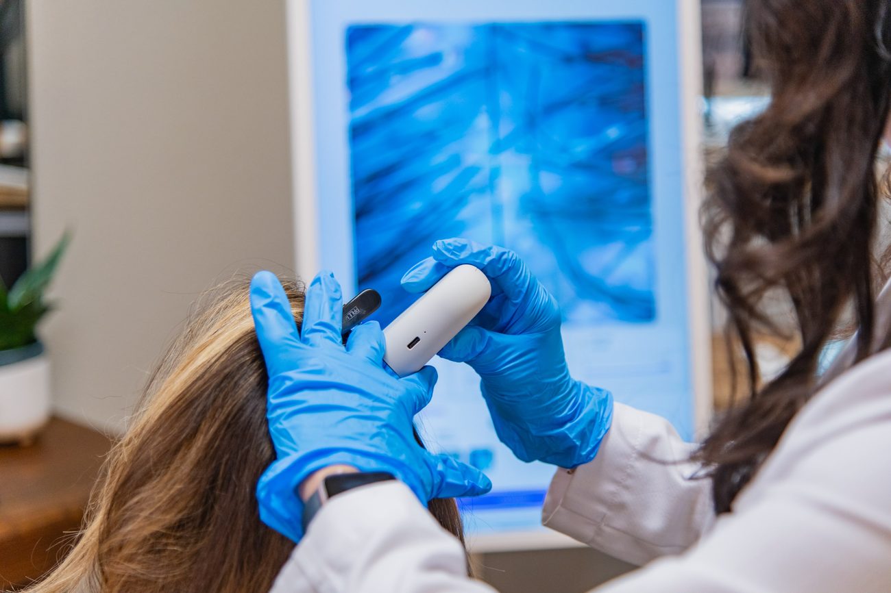 Clinical scalp evaluation in Fort Collins: a trichologist examining a client&rsquo;s scalp with a handheld trichoscope, the magnified view on the screen behind