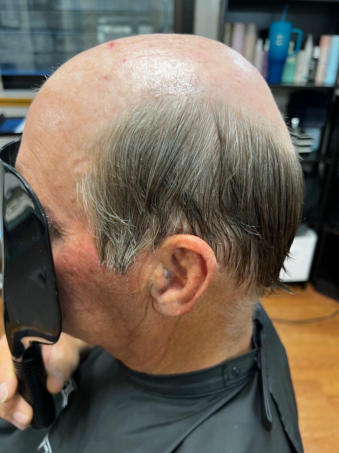 Side view of a man&rsquo;s bald top and crown before hair replacement