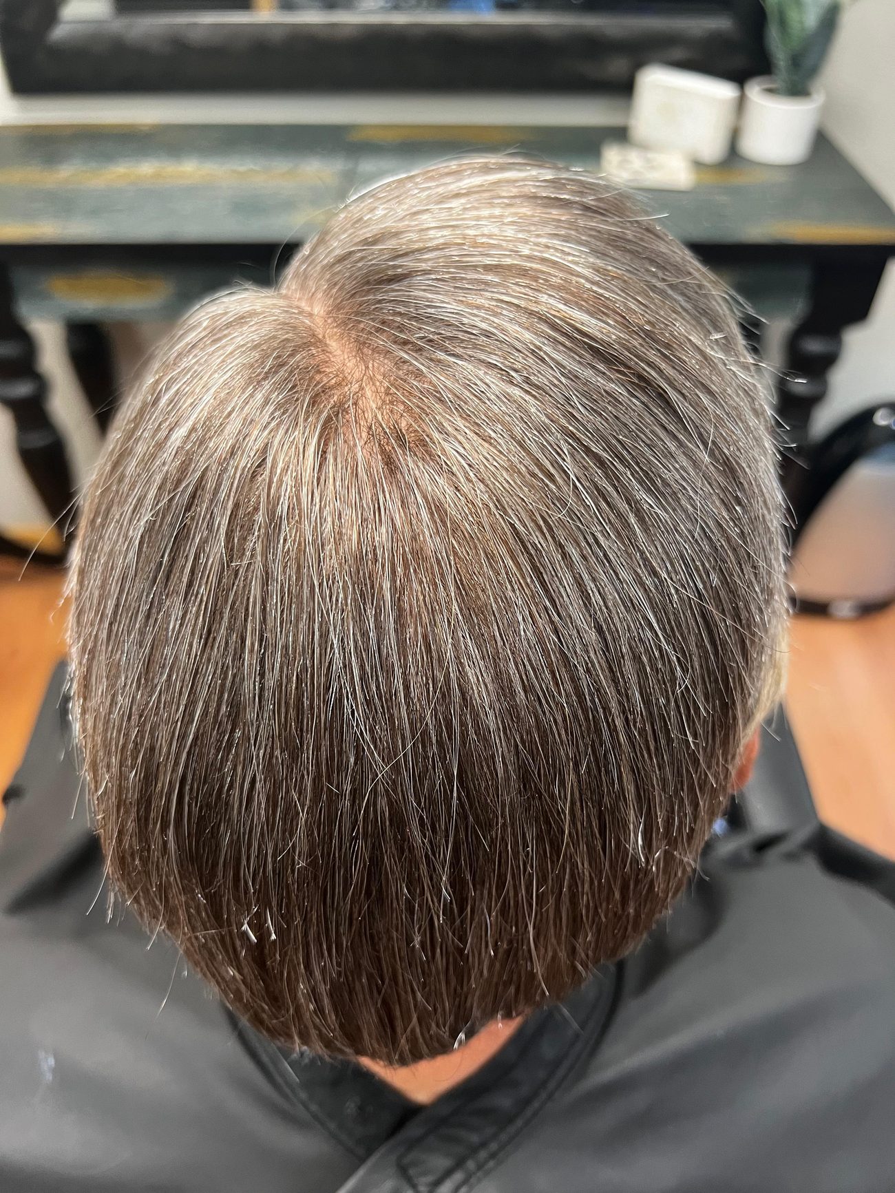 The same crown from above after a hair replacement system was fitted
