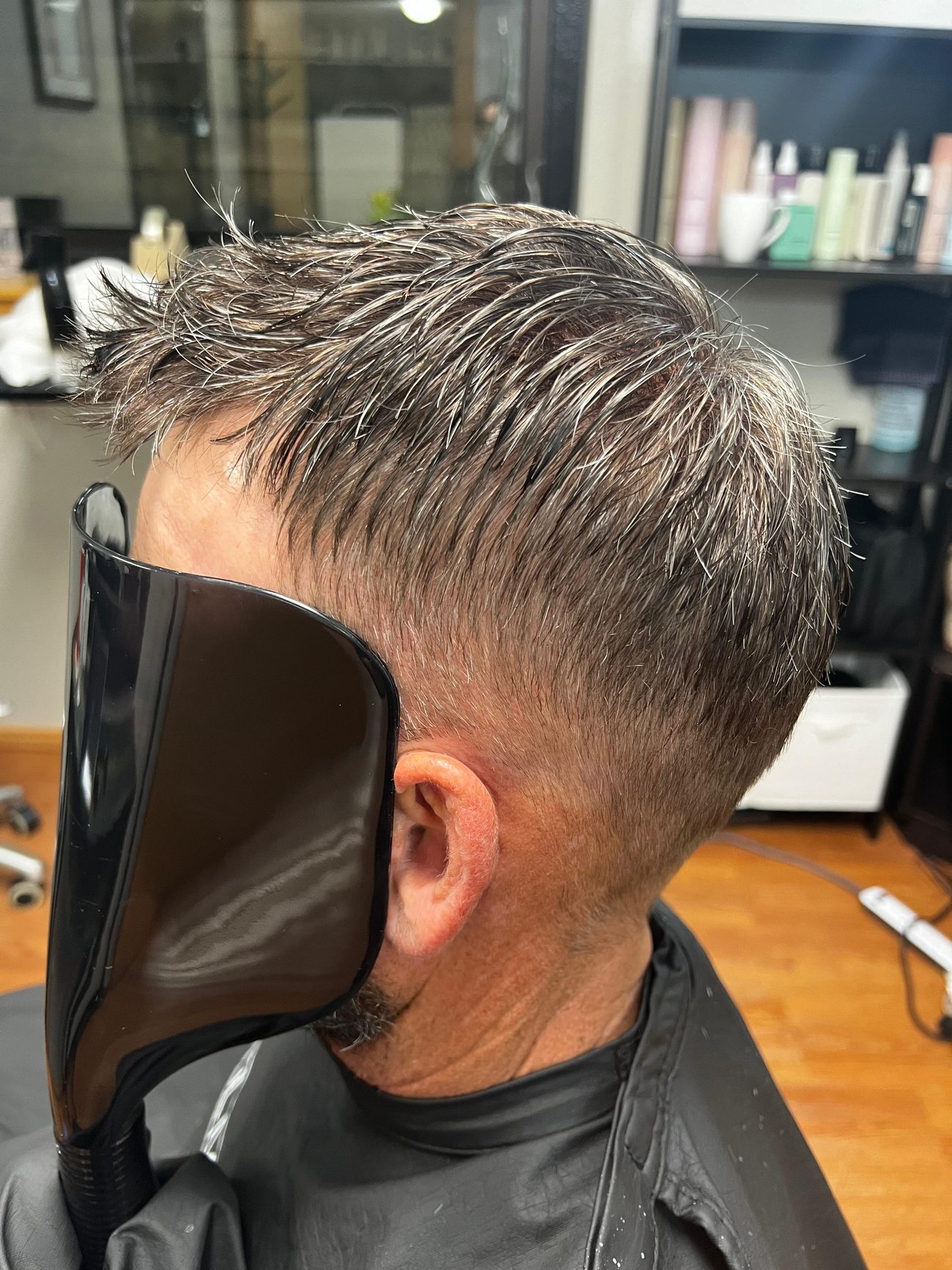 The same side view after a hair replacement system was fitted